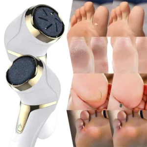 Motorzinho Para Lixar Calos e Rachaduras Ideal Para Pedicures